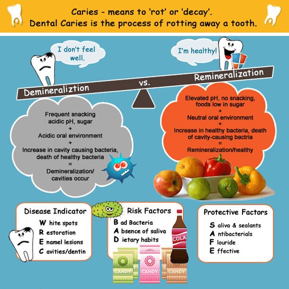 Tooth Decay Process